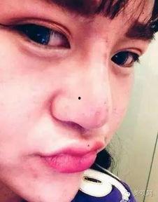 网红在韩国整容医院